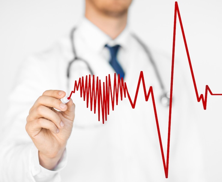 AFib
